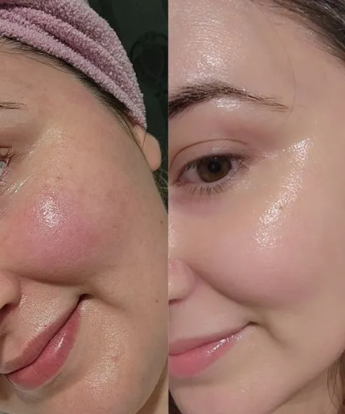 Real customer results after using organic skincare products for dark spots removal