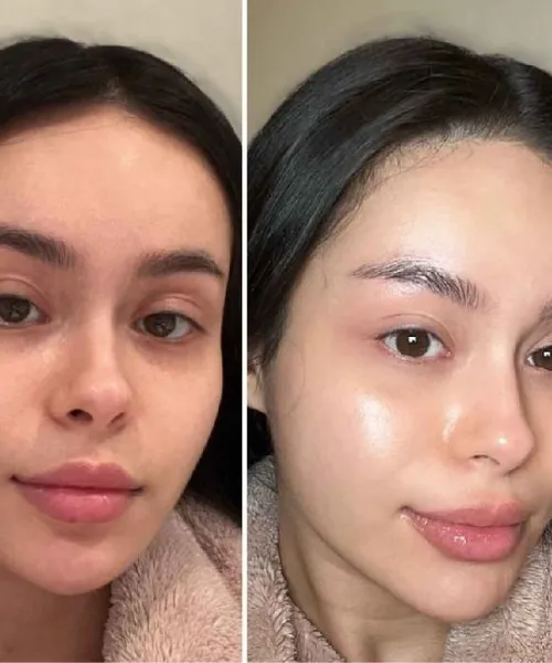 Before and after using organic skincare products for dull to glowing skin transformation